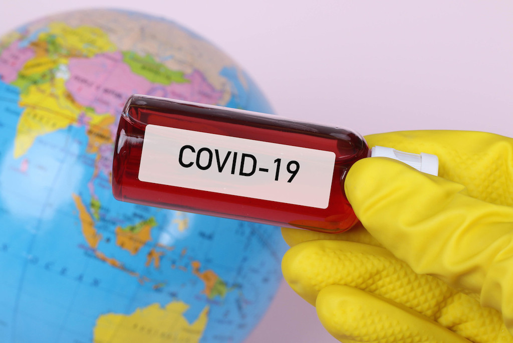 Hand holding blood sample: CC BY 2.0 Marco Verch is a Professional Photographer and Speaker from Cologne.